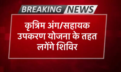 कृत्रिम अंग